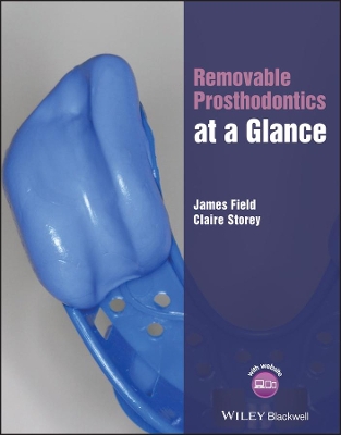 Removable Prosthodontics at a Glance book