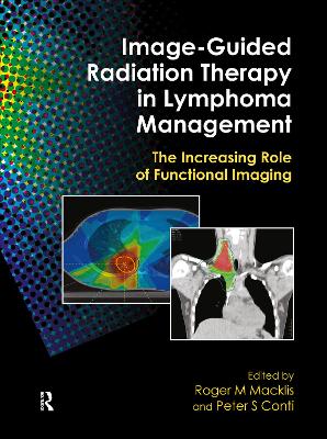 Image-Guided Radiation Therapy in Lymphoma Management book