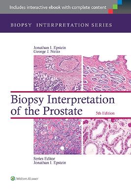 Biopsy Interpretation of the Prostate by Jonathan I. Epstein