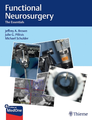 Functional Neurosurgery: The Essentials book