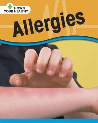 Allergies by Angela Royston