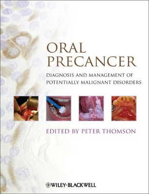 Oral Precancer book