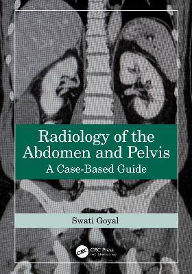 Radiology of the Abdomen and Pelvis: A Case-Based Guide by Swati Goyal