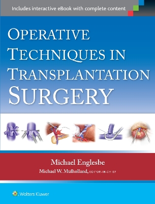 Operative Techniques in Transplantation Surgery book
