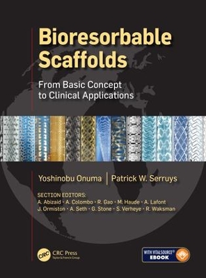 Bioresorbable Scaffolds: From Basic Concept to Clinical Applications by Yoshinobu Onuma