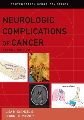 Neurologic Complications of Cancer book