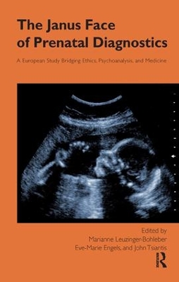 Janus Face of Prenatal Diagnostics by Eve-Marie Engels