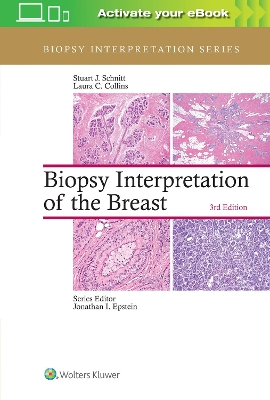 Biopsy Interpretation of the Breast by Stuart J Schnitt