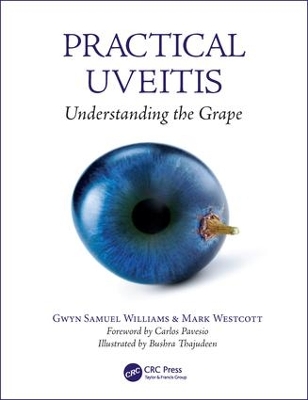 Practical Uveitis book