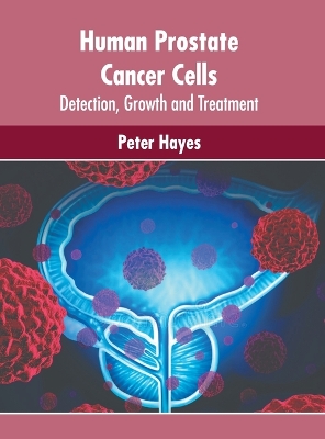 Human Prostate Cancer Cells: Detection, Growth and Treatment book