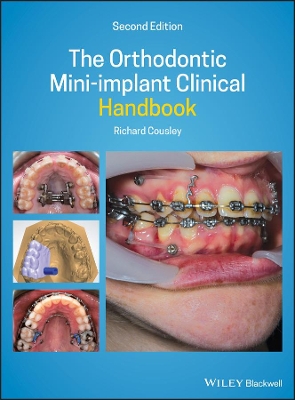 The Orthodontic Mini-implant Clinical Handbook by Richard Cousley