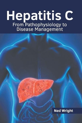 Hepatitis C: From Pathophysiology to Disease Management book