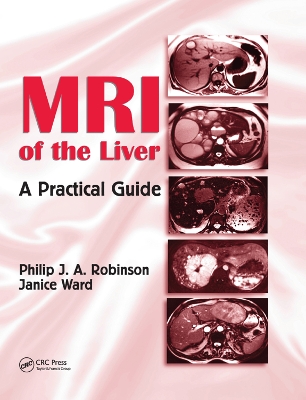 MRI of the Liver: A Practical Guide book