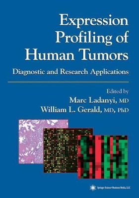 Expression Profiling of Human Tumors by Marc Ladanyi