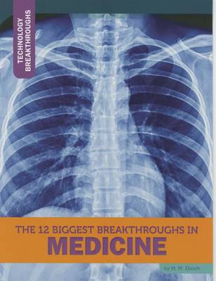 12 Biggest Breakthroughs in Medicine book
