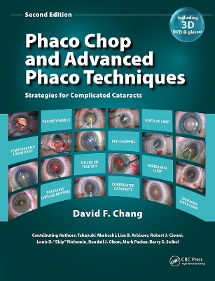 Phaco Chop and Advanced Phaco Techniques: Strategies for Complicated Cataracts book