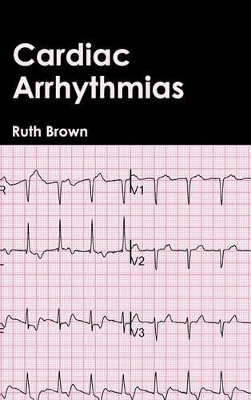 Cardiac Arrhythmias book