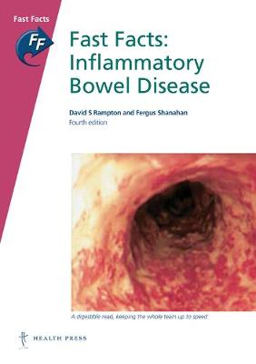 Fast Facts: Inflammatory Bowel Disease by David S Rampton