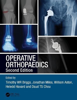 Operative Orthopaedics book