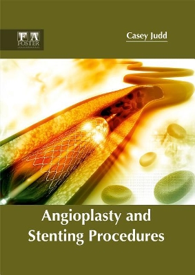 Angioplasty and Stenting Procedures book