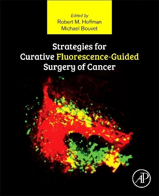 Strategies for Curative Fluorescence-guided Surgery of Cancer book