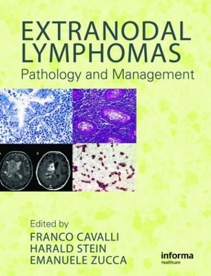 Extranodal Lymphomas book