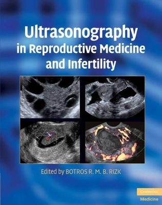 Ultrasonography in Reproductive Medicine and Infertility book