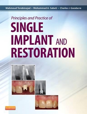 Principles and Practice of Single Implant and Restoration book