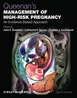 Queenan's Management of High-Risk Pregnancy: An Evidence-Based Approach by Catherine Y. Spong