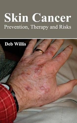 Skin Cancer book