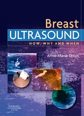 Breast Ultrasound book