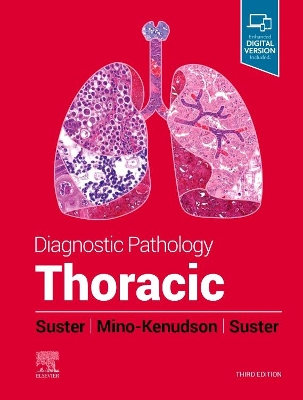 Diagnostic Pathology: Thoracic by Saul Suster