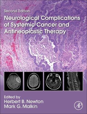 Neurological Complications of Systemic Cancer and Antineoplastic Therapy by Herbert B. Newton