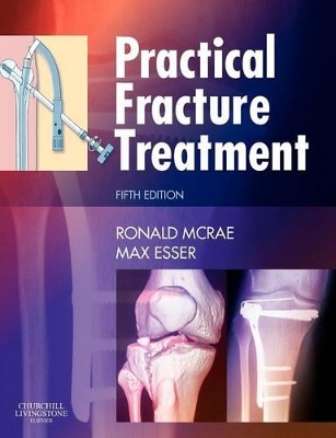 Practical Fracture Treatment book