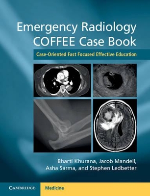 Emergency Radiology COFFEE Case Book book