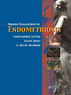 Modern Management of Endometriosis by Christopher Sutton