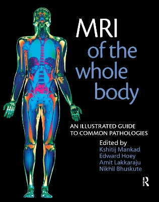 MRI of the Whole Body book