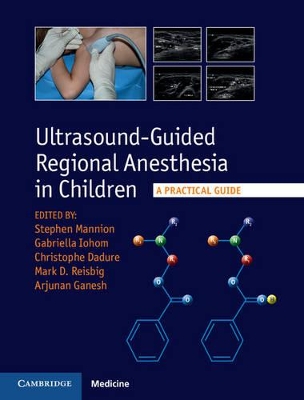 Ultrasound-Guided Regional Anesthesia in Children book