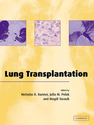 Lung Transplantation by Nicholas R. Banner