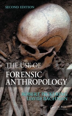 Use of Forensic Anthropology book