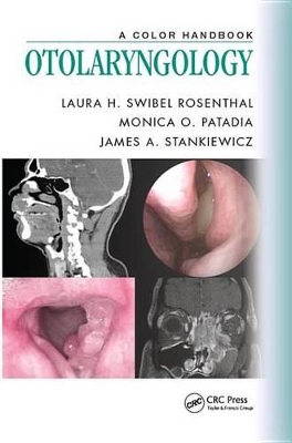 Otolaryngology: A Color Handbook by Laura H. Swibel Rosenthal