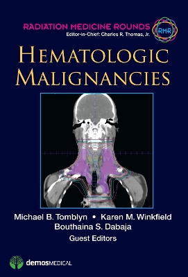 Hematologic Malignancies book