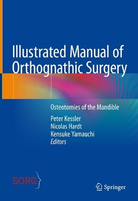 Illustrated Manual of Orthognathic Surgery: Osteotomies of the Mandible book