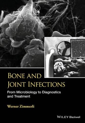 Bone and Joint Infections book