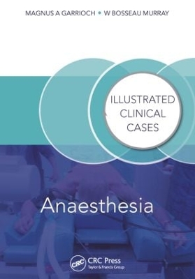 Anaesthesia book