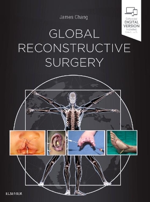 Global Reconstructive Surgery book