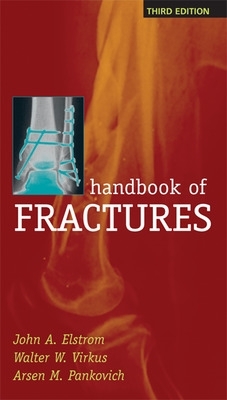 Handbook of Fractures book