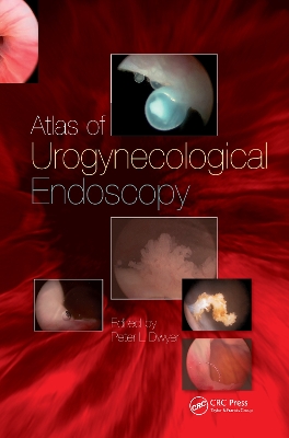 Handbook of Urologic Cryoablation book