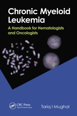 Chronic Myeloid Leukemia book
