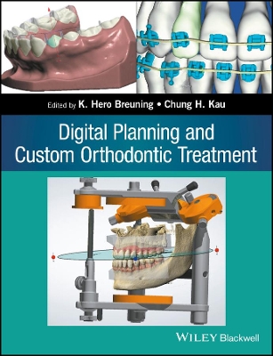 Digital Planning and Custom Orthodontic Treatment book